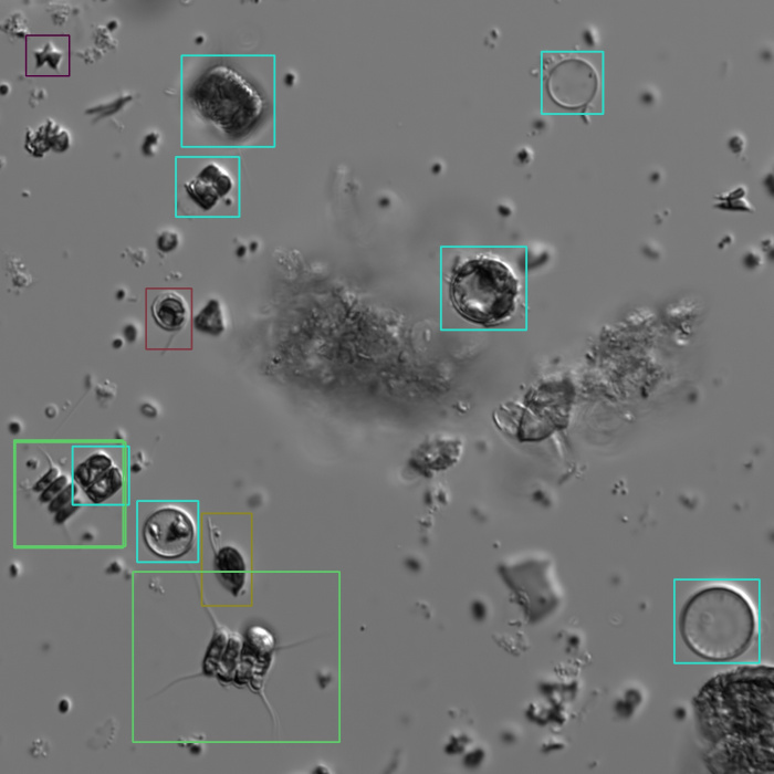 Microscopy image of plankton with detection results