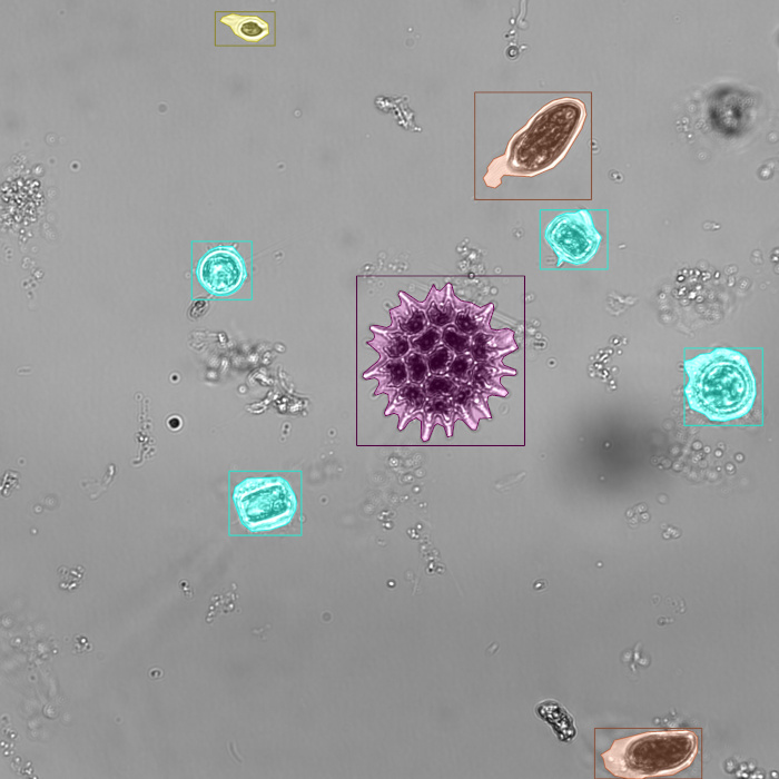 Microscopy image of plankton with segmentation results