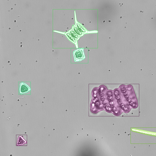 Microscopy image of plankton with detection results