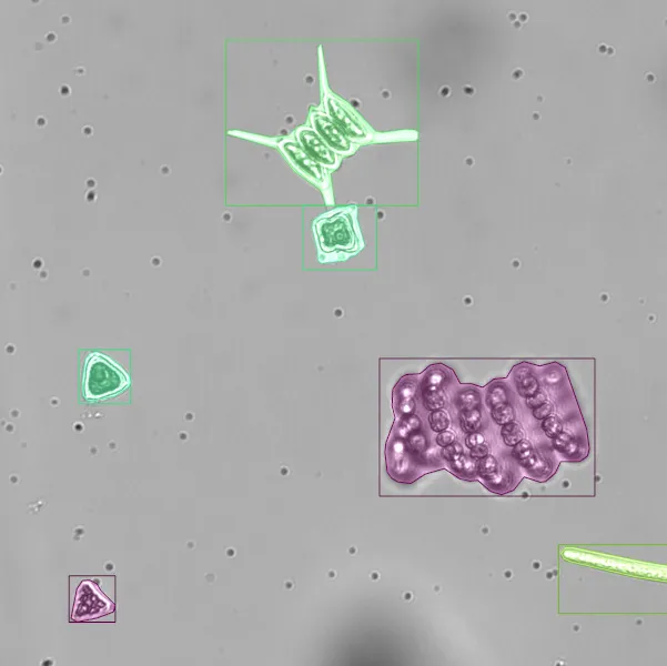 Microscopy image of plankton with detection results