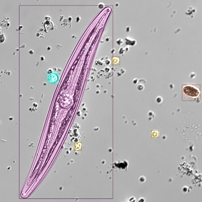 Microscopy image with segmentation results
